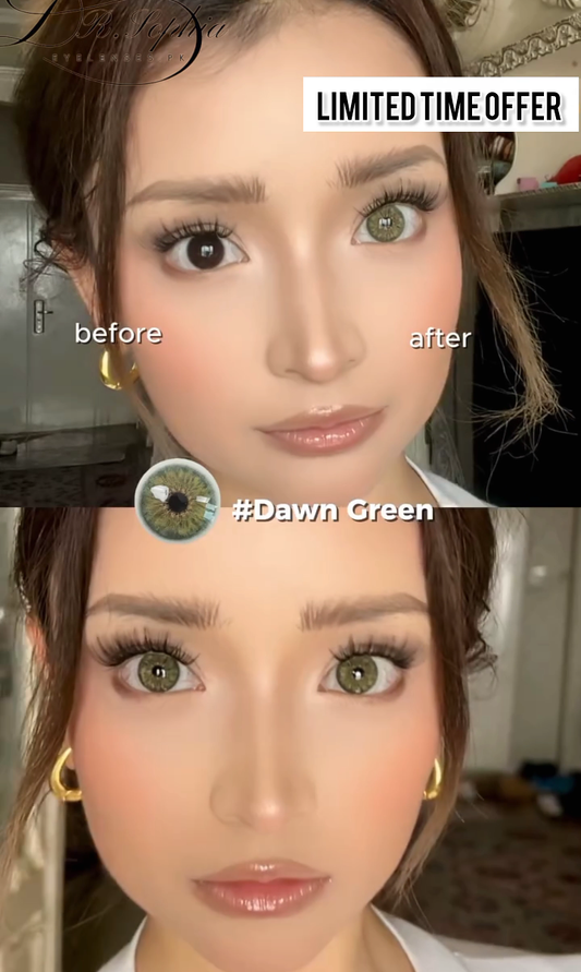 DAWN GREEN (HOT N SALE)
